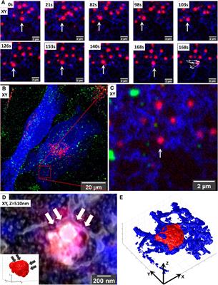 Correlative Organelle Microscopy: Fluorescence Guided Volume Electron Microscopy of Intracellular Processes
